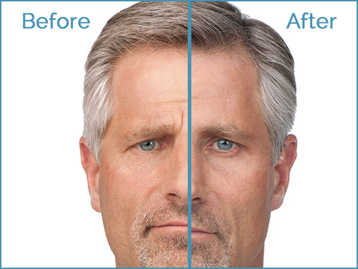 Before and after hair transformation comparison image