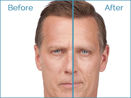 Before and after transformation comparison.