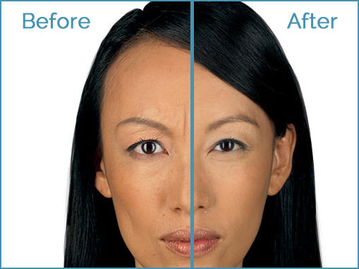 Before and after makeup transformation comparison.