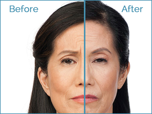 Comparison of facial appearance before and after.