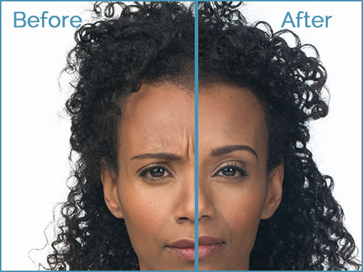 Before and after facial transformation comparison.