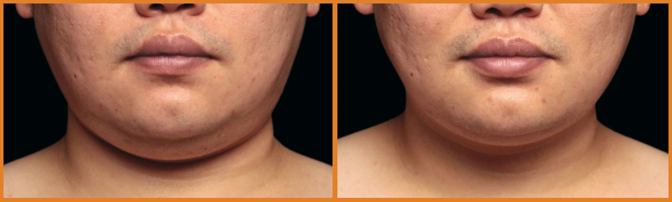 Comparative view of male facial features.